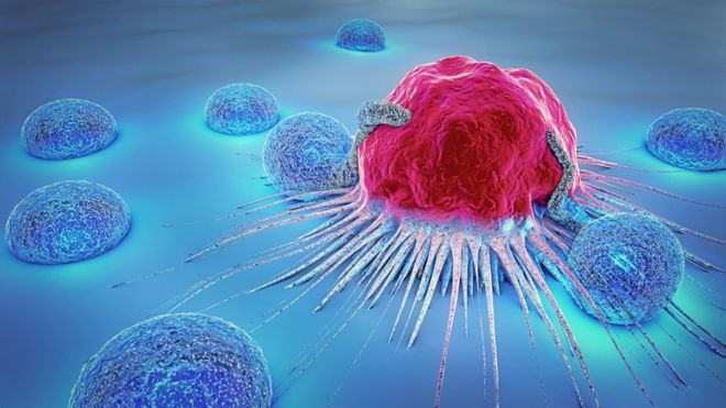 Artificial intelligence used to predict cancer growth